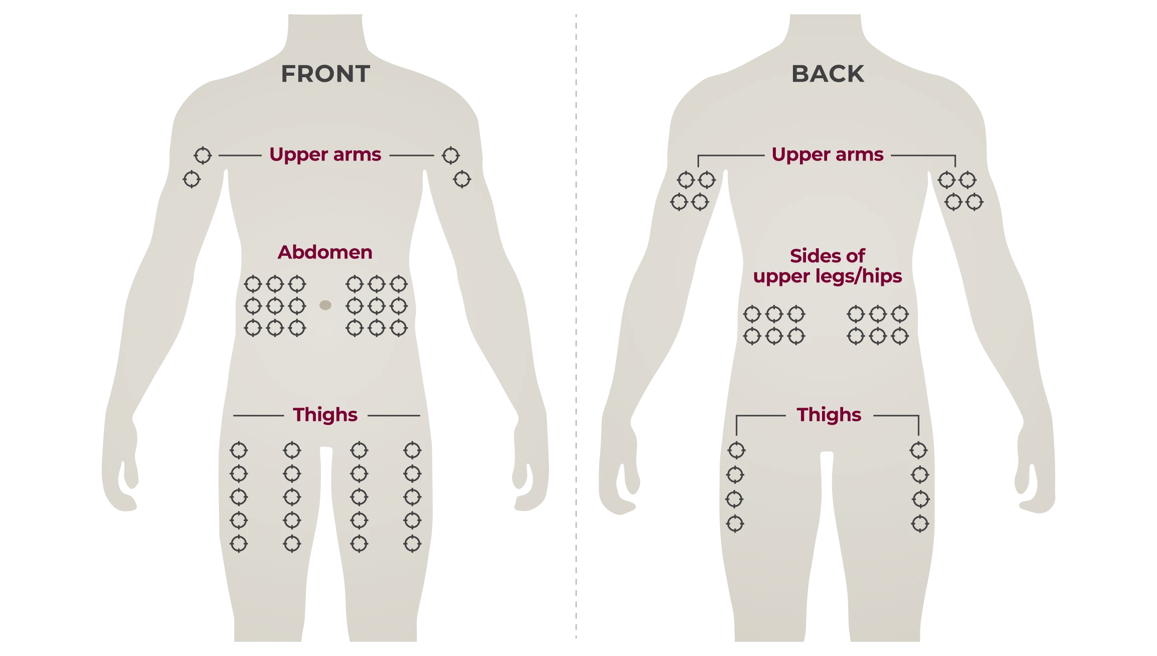 Body diagram of recommended Hizentra subcutaneous infusion sites, front and back views